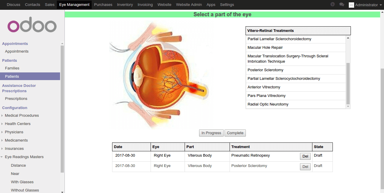 eye_management11 (1)