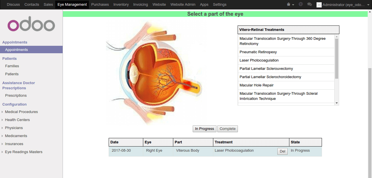 eye_management12 (1)