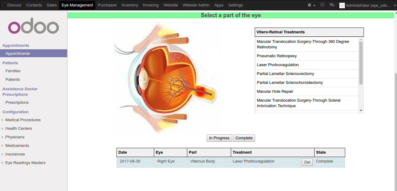 eye_management13 (1)