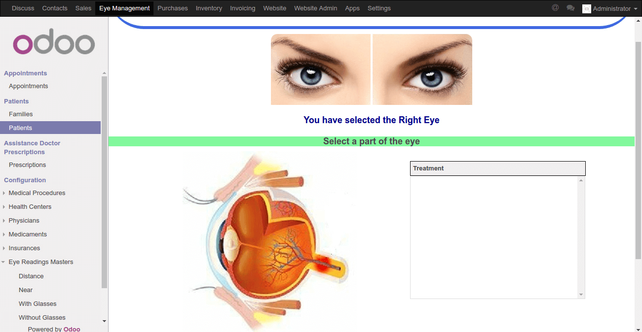 eye_management5 (1)